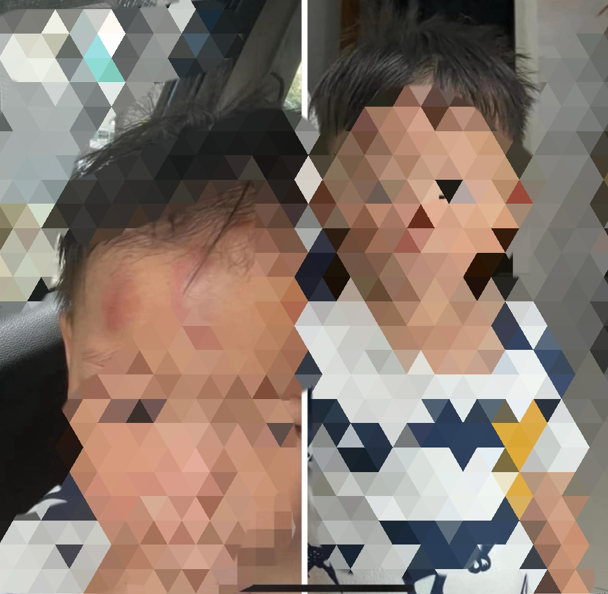 有家长在脸书社团PO出小孩在虎尾某家托婴中心跌倒撞到柜子,额头严重瘀青,向业者要求调阅监视器,业者却称「监视器网路线坏掉」,无法提供影像。(撷取自社团贴文)
有家长在脸书社团PO出小孩在虎尾某家托婴中心跌倒撞到柜子,额头严重瘀青,向业者要求调阅监视器,业者却称「监视器网路线坏掉」,无法提供影像。(撷取自社团贴文)